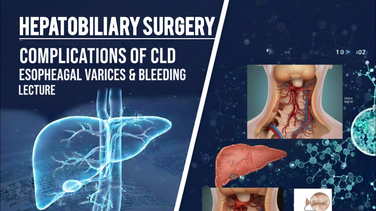 Esophageal Varices & Variceal Bleeding in CLD | Hepatobiliary Surgery Lecture