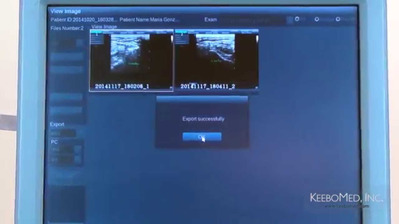 SonoScape S2 Color Ultrasound  | Exporting Images to USB Drive