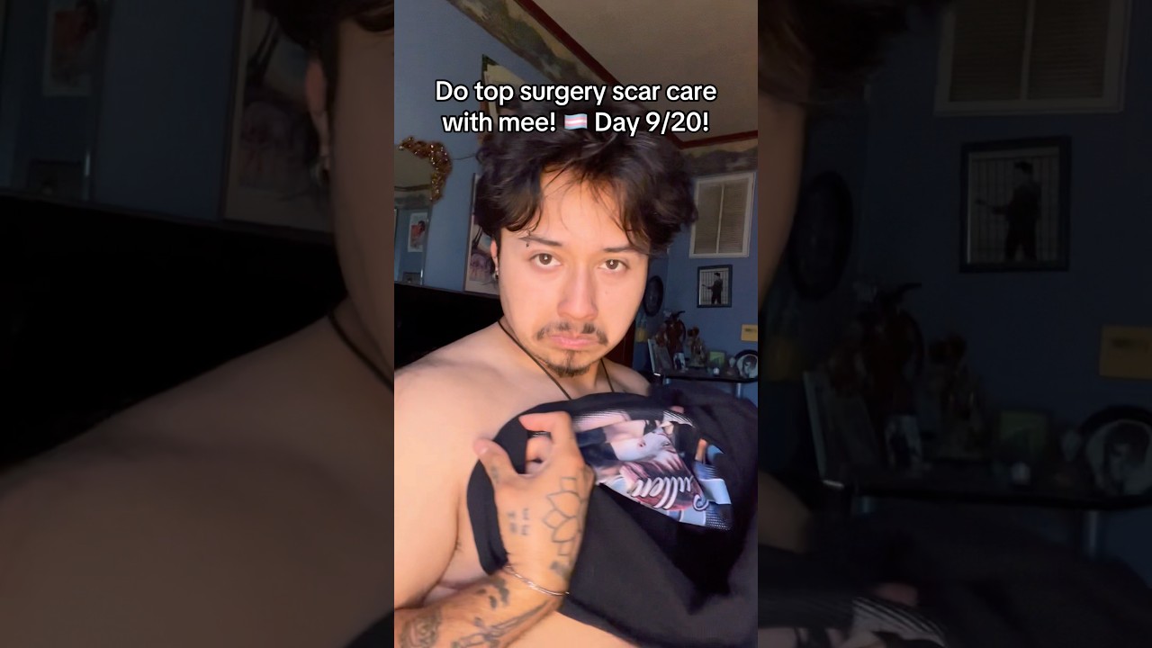 Reminder! #fy#trans#ftm#foryoupage#lgbt#transman#sub#transrights#transgender#fyp#ytshorts#yt#hrt
