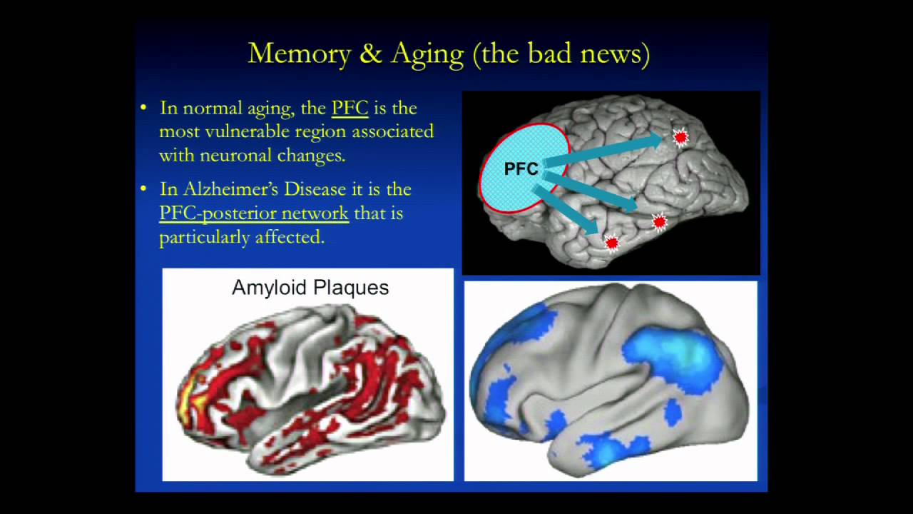 Human Memory, Aging and the Brain or Where Did I Put Those Keys?