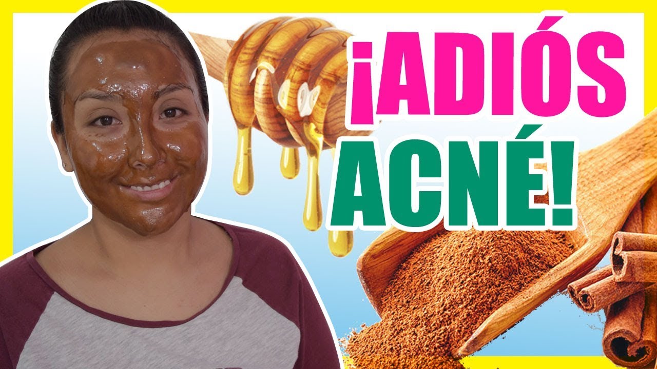 MASCARILLA de MIEL y CANELA para el ACNÉ | Mascarillas Naturales | Nadia Elias