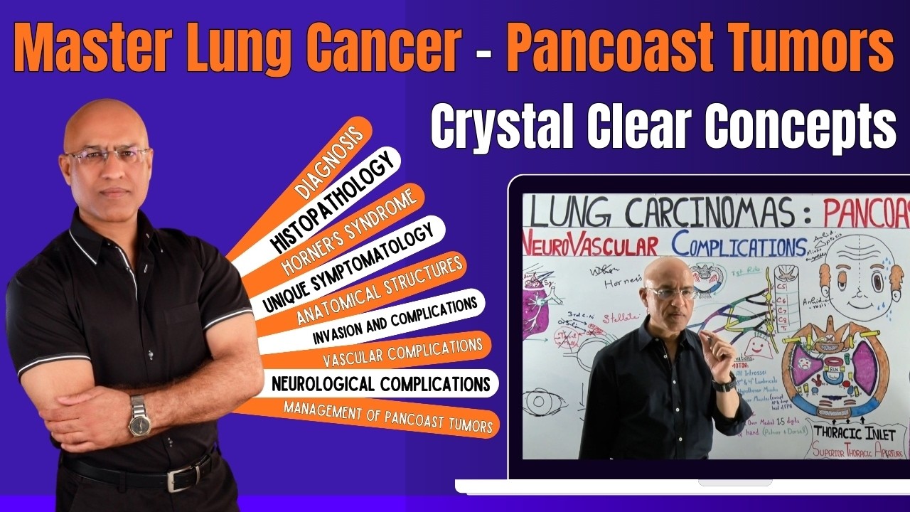 Pancoast Tumor | Lung Carcinoma Master With Clinical Significance