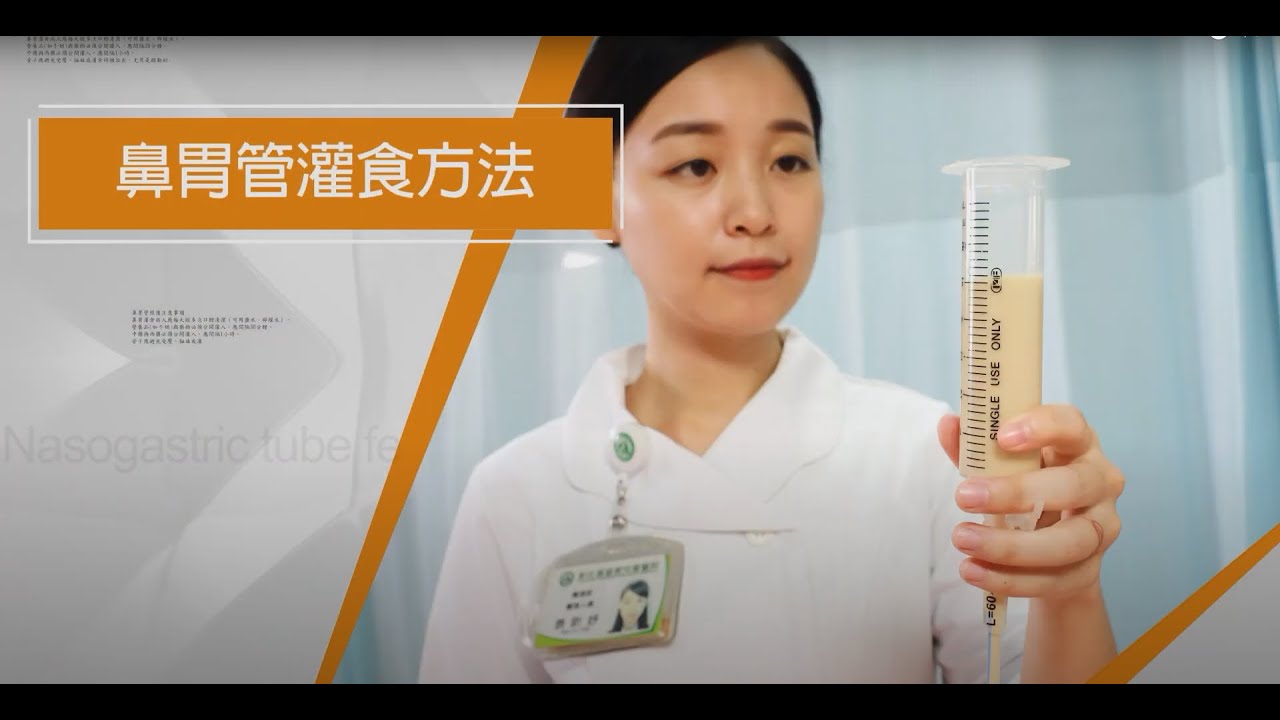(兩截式)鼻胃管灌食衛教影片-(國語版)20250701