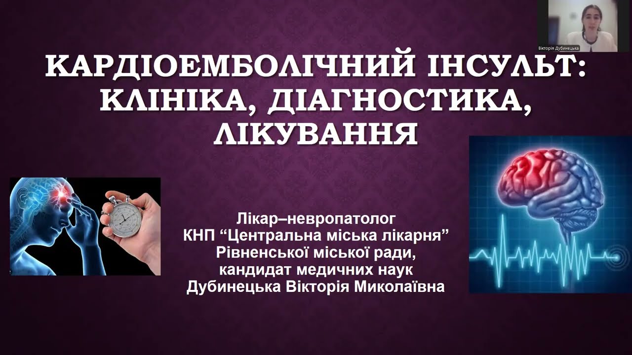 Кардіоемболічний інсульт: клініка, діагностика, лікування (2026)