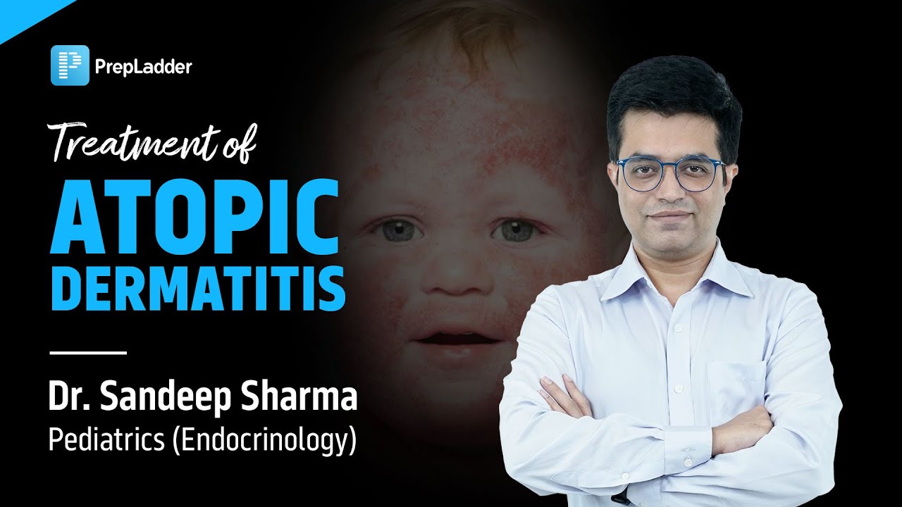 Treatment of Atopic Dermatitis | Pediatrics Endocrinology