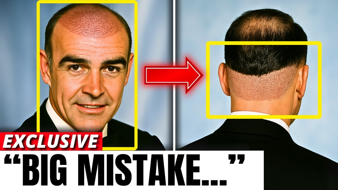 Golden Age Stars With the WORST Hidden Hair Loss
