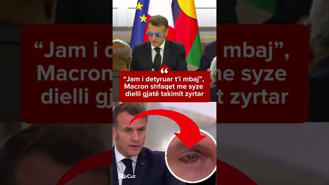 “Jam i detyruar t’i mbaj”, Macron shfaqet me syze dielli gjatë takimit zyrtar