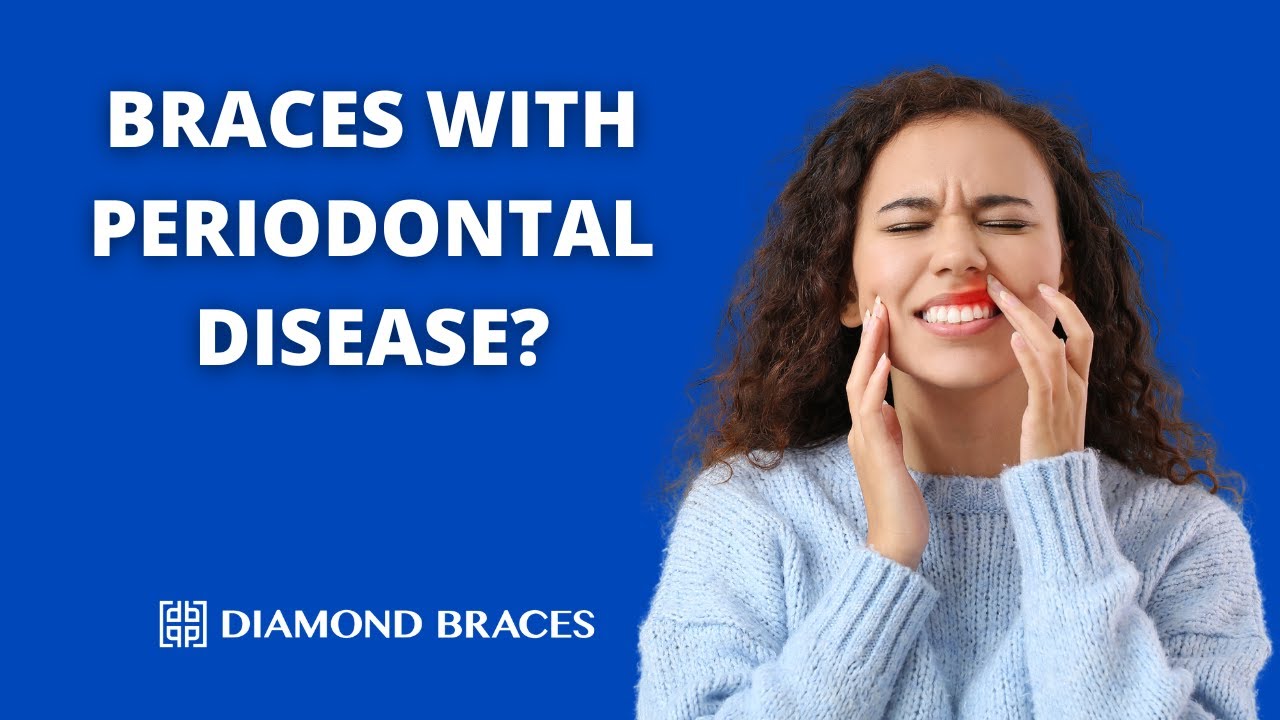 Can Someone with Periodontal Disease Get Braces?