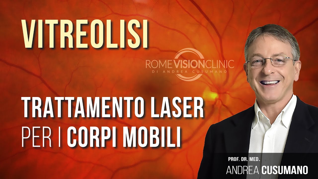 La vitreolisi: il trattamento laser per i corpi mobili vitreali