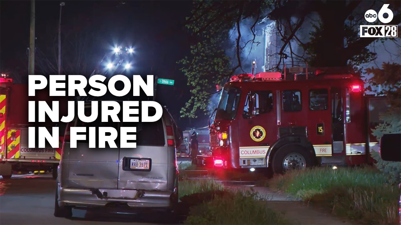 Person injured in Columbus house fire