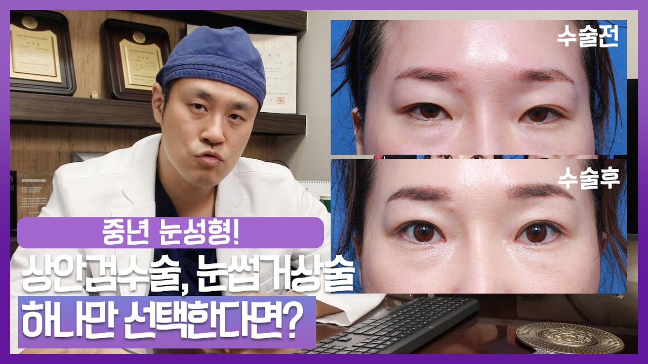 중년 눈성형 상안검수술, 눈썹하거상술 하나만 택한다면?