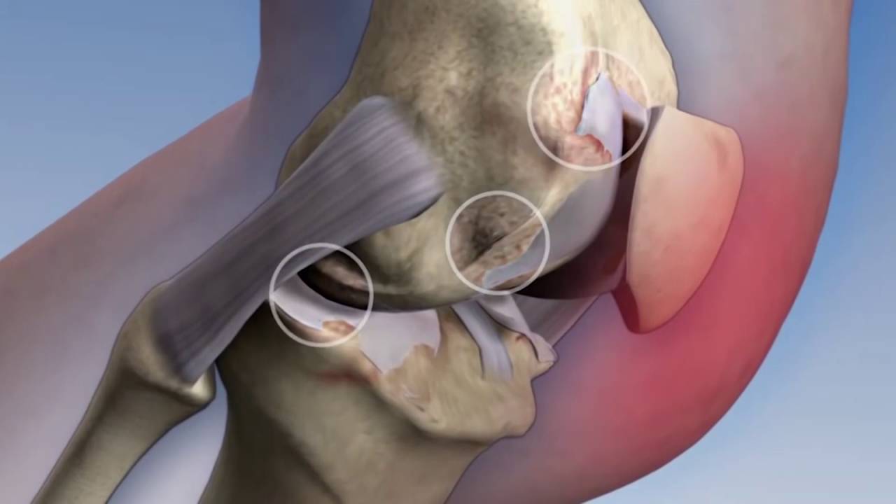 Medicina para todos: Tratamientos con c&eacute;lulas madre en articulaciones