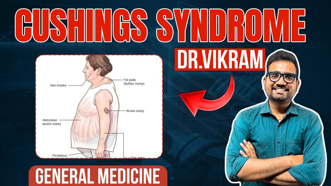 CUSHINGS SYNDROME | DR. VIKRAM C