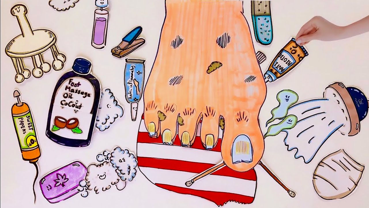 [Paper ASMR 🪸] Ingrown toenail care  ASMR  #紙遊び #紙遊戲 #sweetpapers