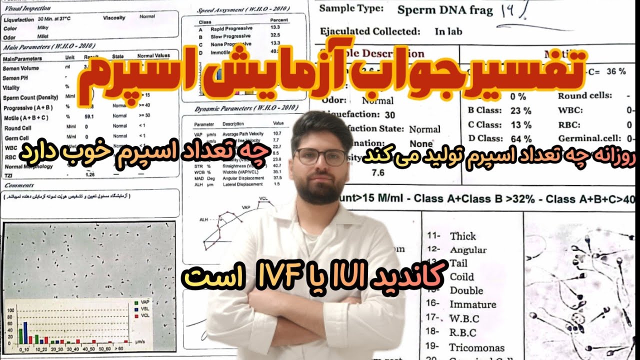 تفسیر جواب آزمایش اسپرم، خودت تعیین کن روزانه چه تعداد اسپرم تولید می کنی،