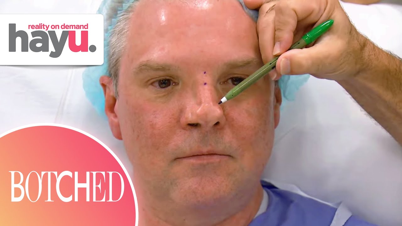 Patient's Nose Deformed By Mother's IUD | Season 7 | Botched