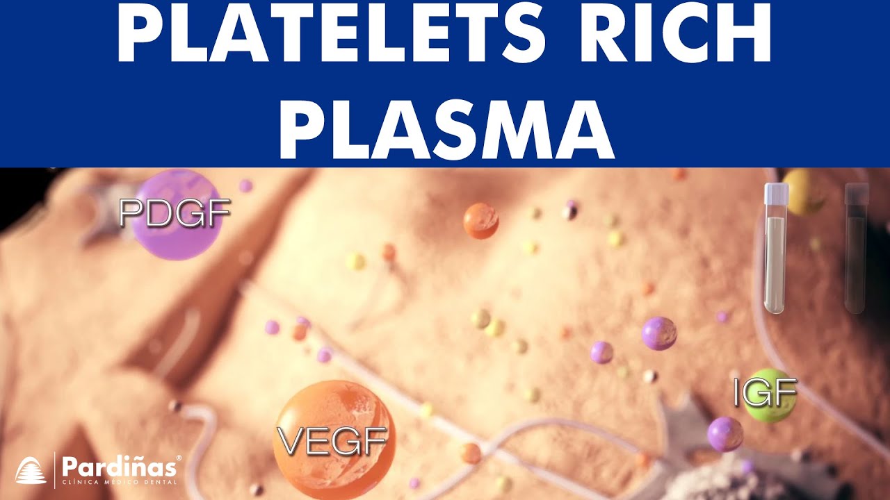 Platelet Rich Plasma - PRP - Tissue regeneration ©