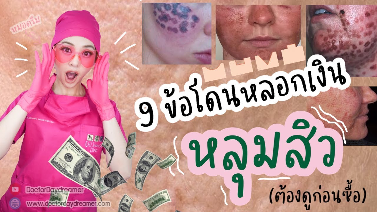 เตือนภัย 9 ข้อ โดนหลอกเงินรักษา #หลุมสิว สิ่งที่คนขายไม่เคยบอกคุณ | Dr. Dream Clinic #acnescar