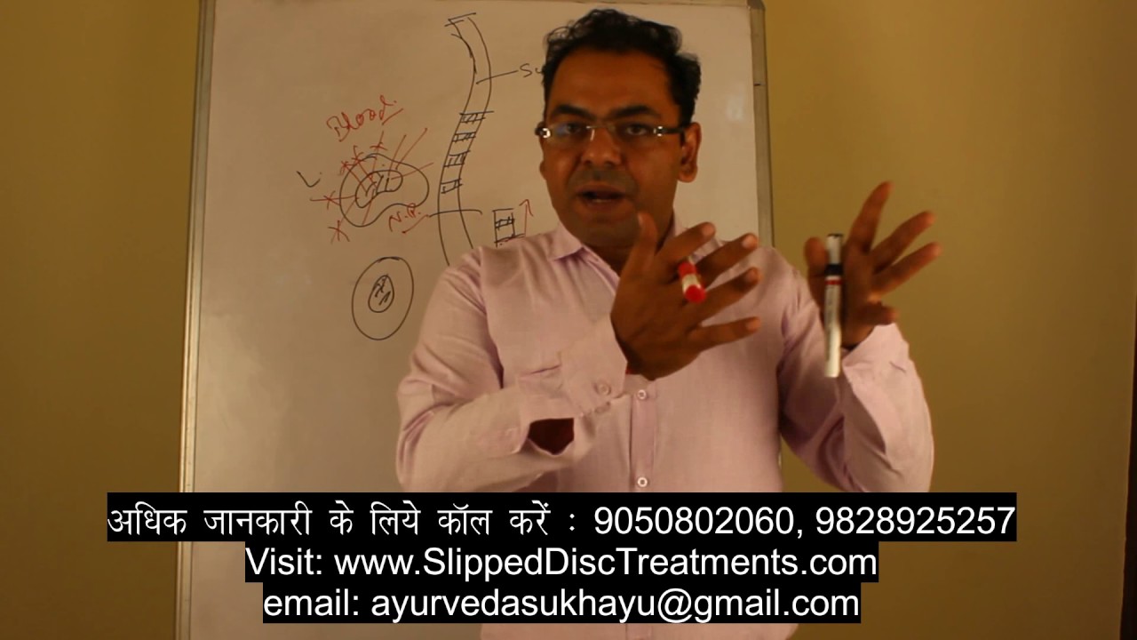 स्लिप  डिस्क का इलाज़ बिना सर्जरी कैसे संभव है