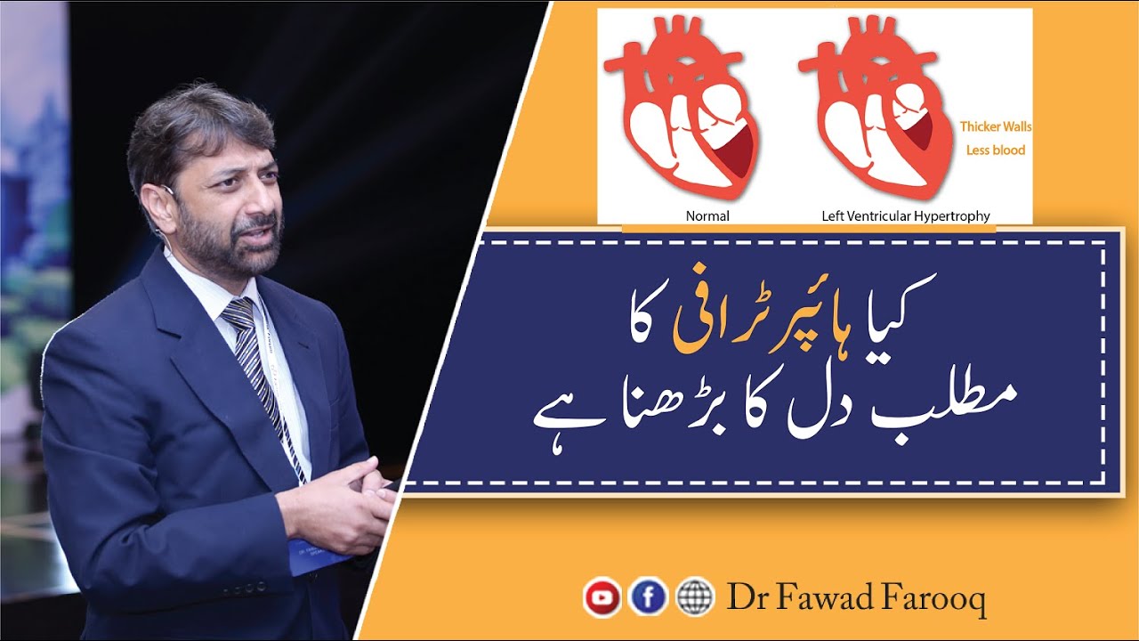 Heart Enlargement and hypertrophy difference.Urdu/Hindi Dr.Fawad Farooq
