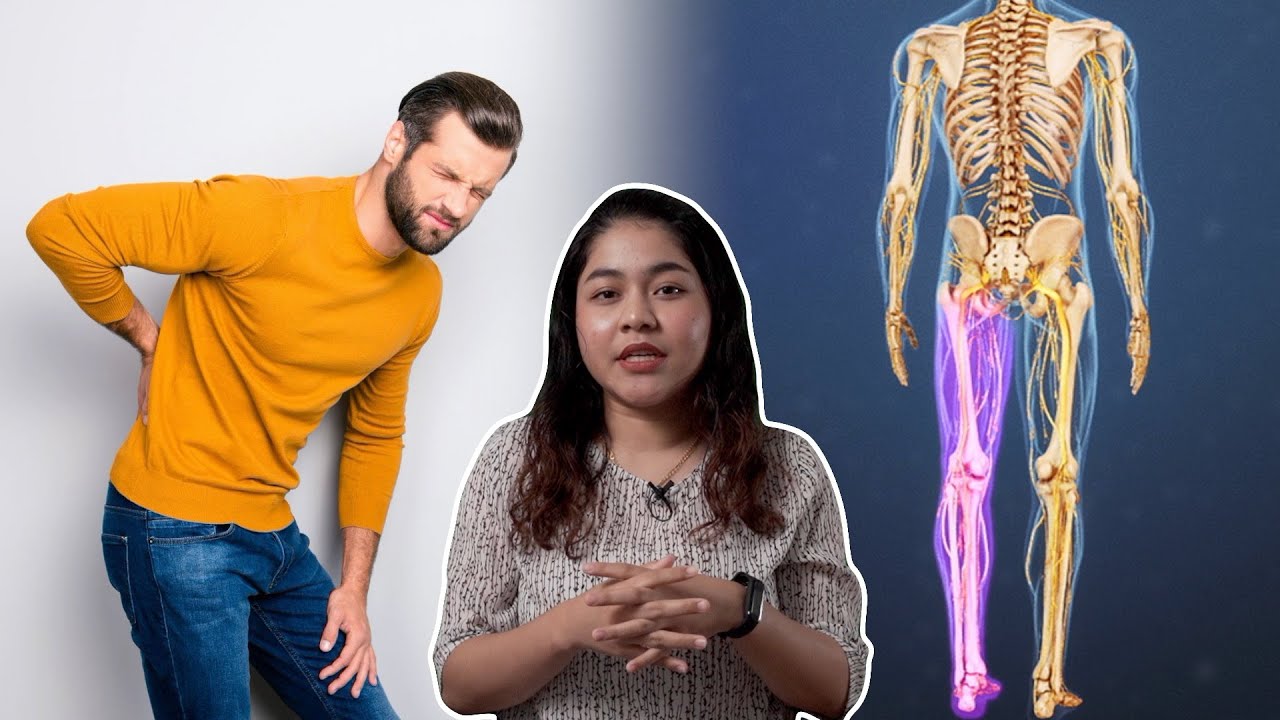 Piriformis Syndrome: Sakit Dekat Punggung