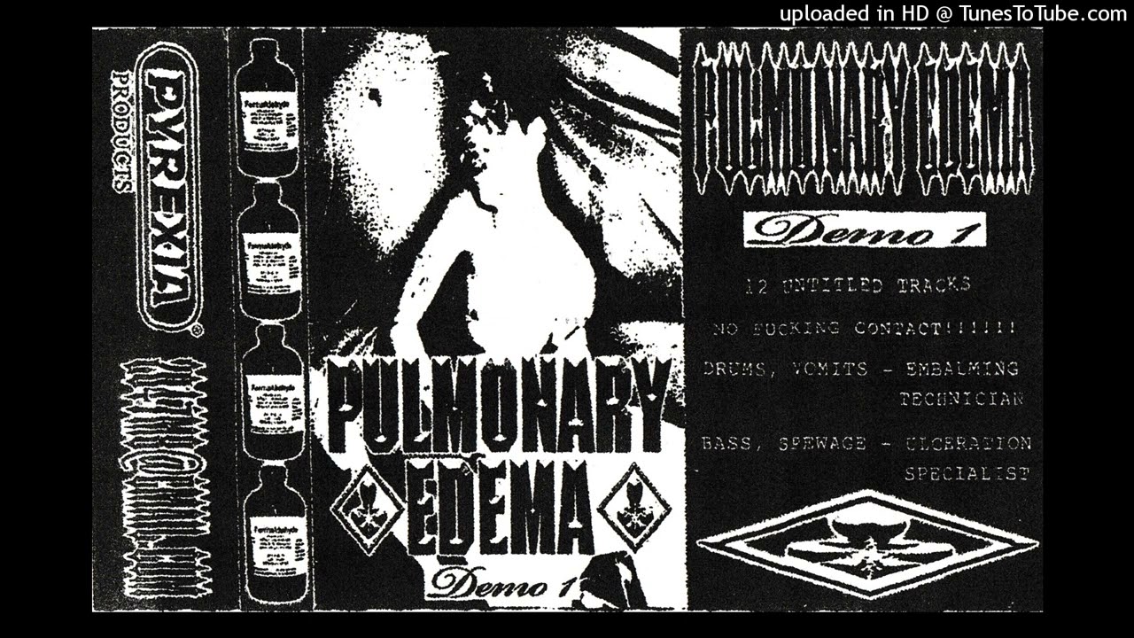 PULMONARY EDEMA - DEMO 1