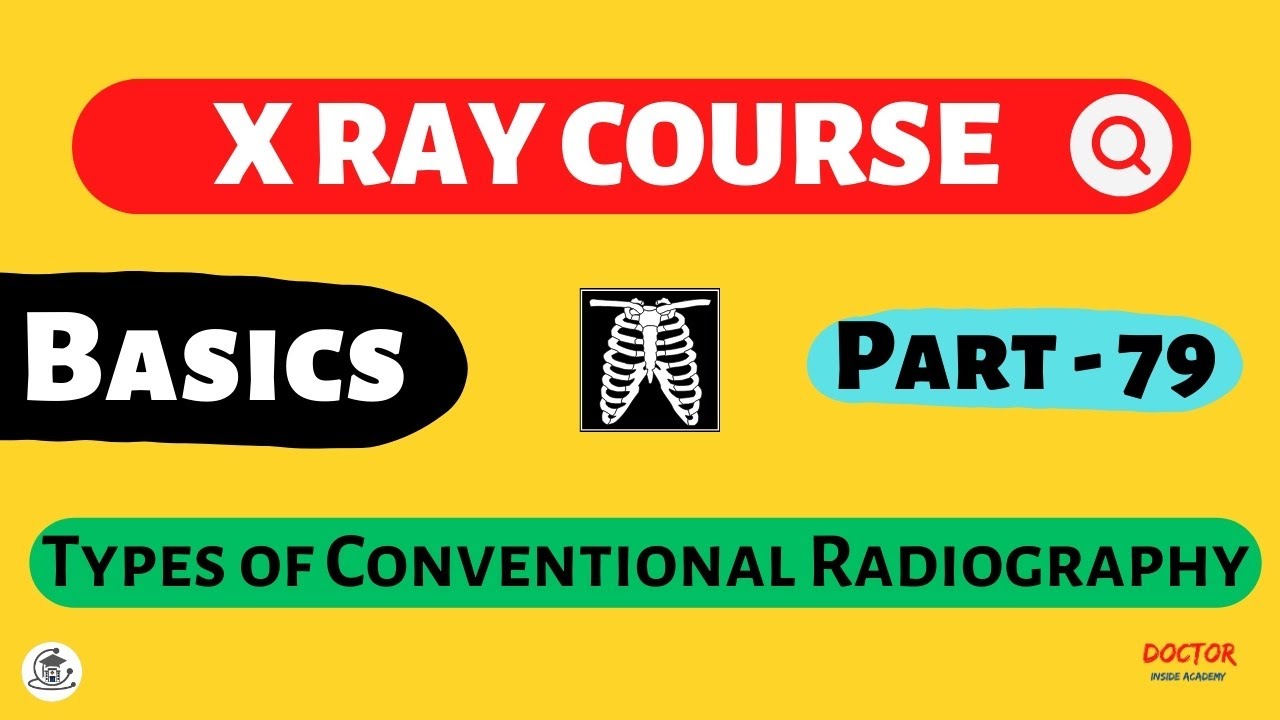 Types of Conventional Radiography | Part - 79 | X Ray Course | Doctor Inside Academy