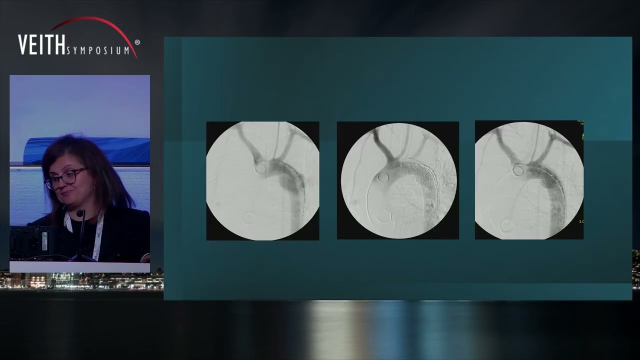 Management of Blunt Aortic Injury: Real-World Experience