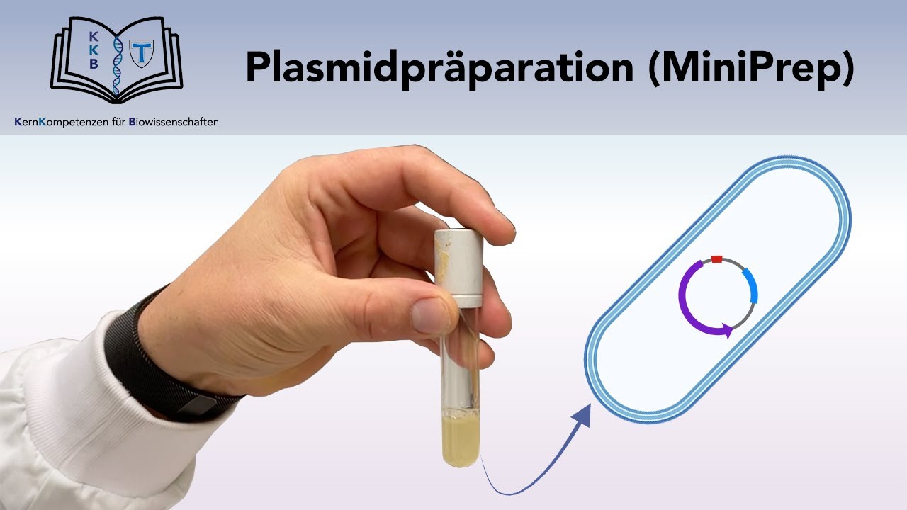 PLASMIDPR&Auml;PARATION (MINIPREP)