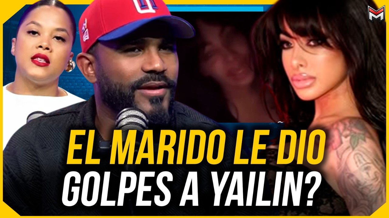 YAILIN APARECE CON UN OJO GOLPEADO !