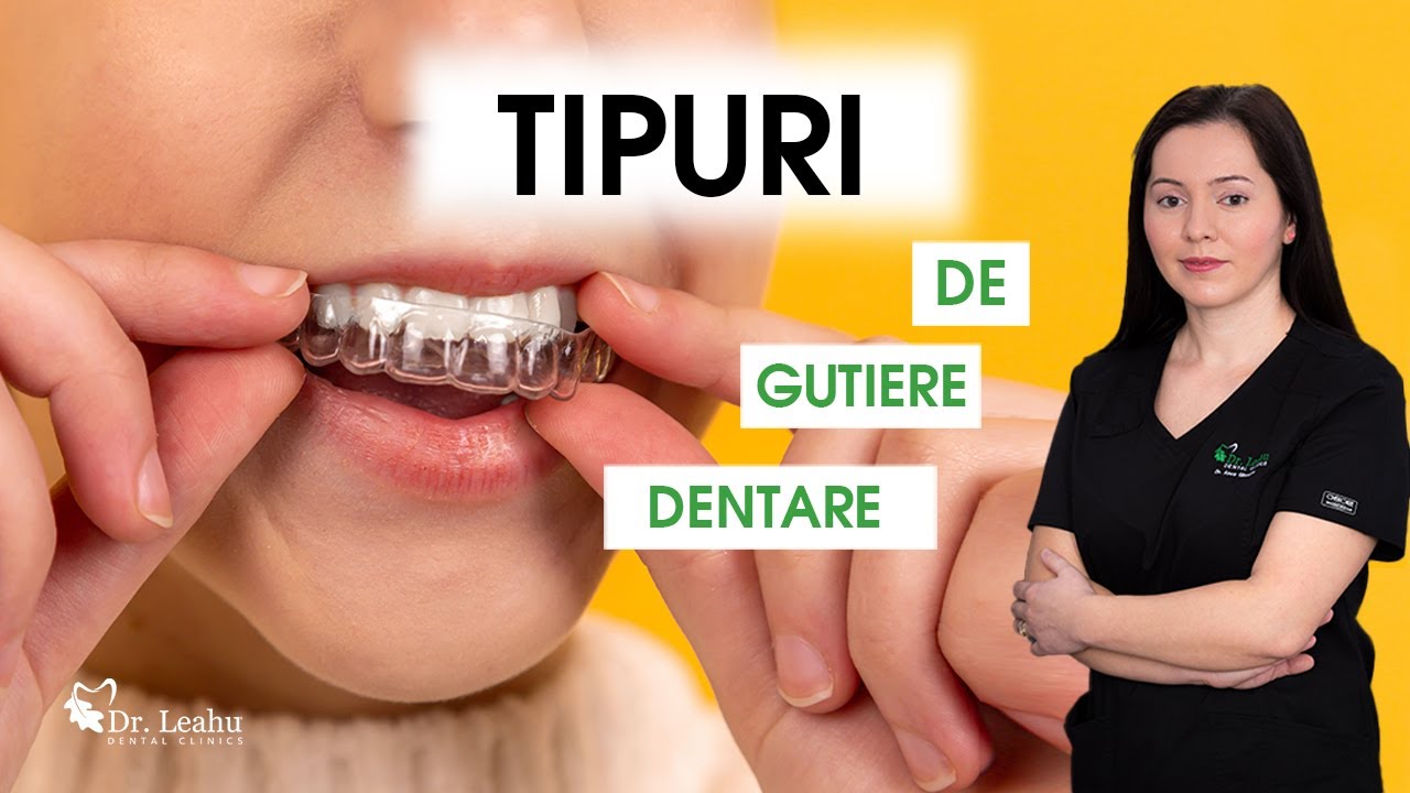 Gutiera dentara ce este, tipuri, cum se foloseste, pret - Clinicile Dentare Dr. Leahu