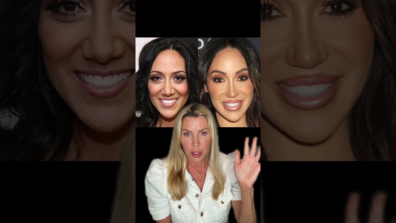 Celebrity Review | Melissa Gorga | Before and After Analysis