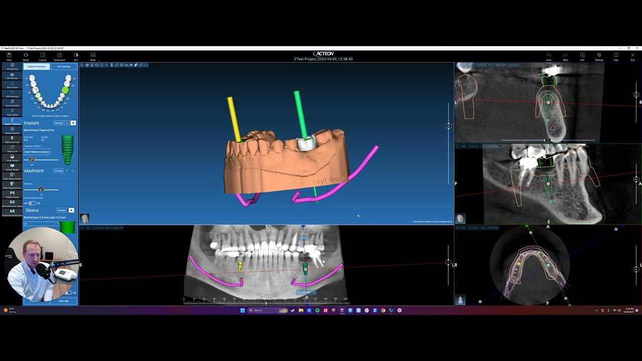 10.0: Acteon Walkthrough Videos -  