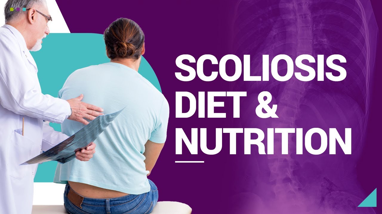 Scoliosis Diet & Nutrition