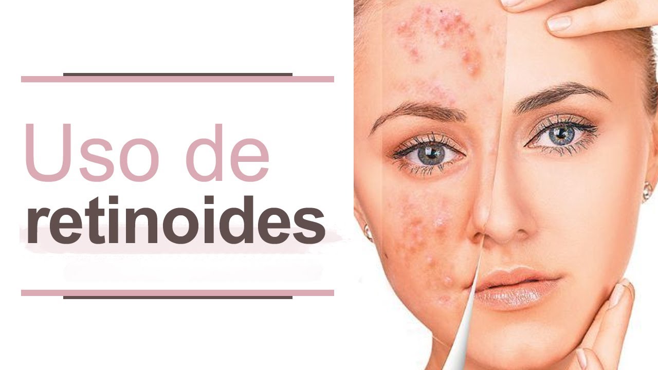 Guía para el uso de retinoides  l Dra. María Clara Mejía