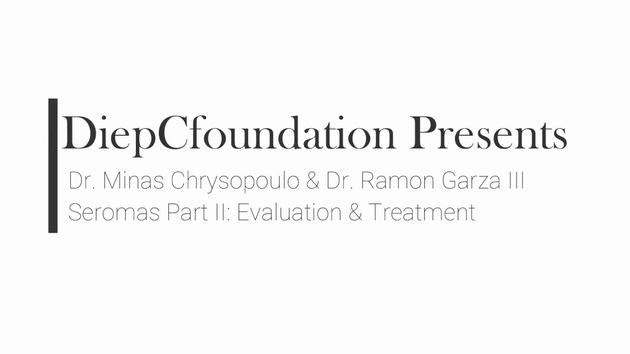 Seromas Part II: Evaluation and Treatment