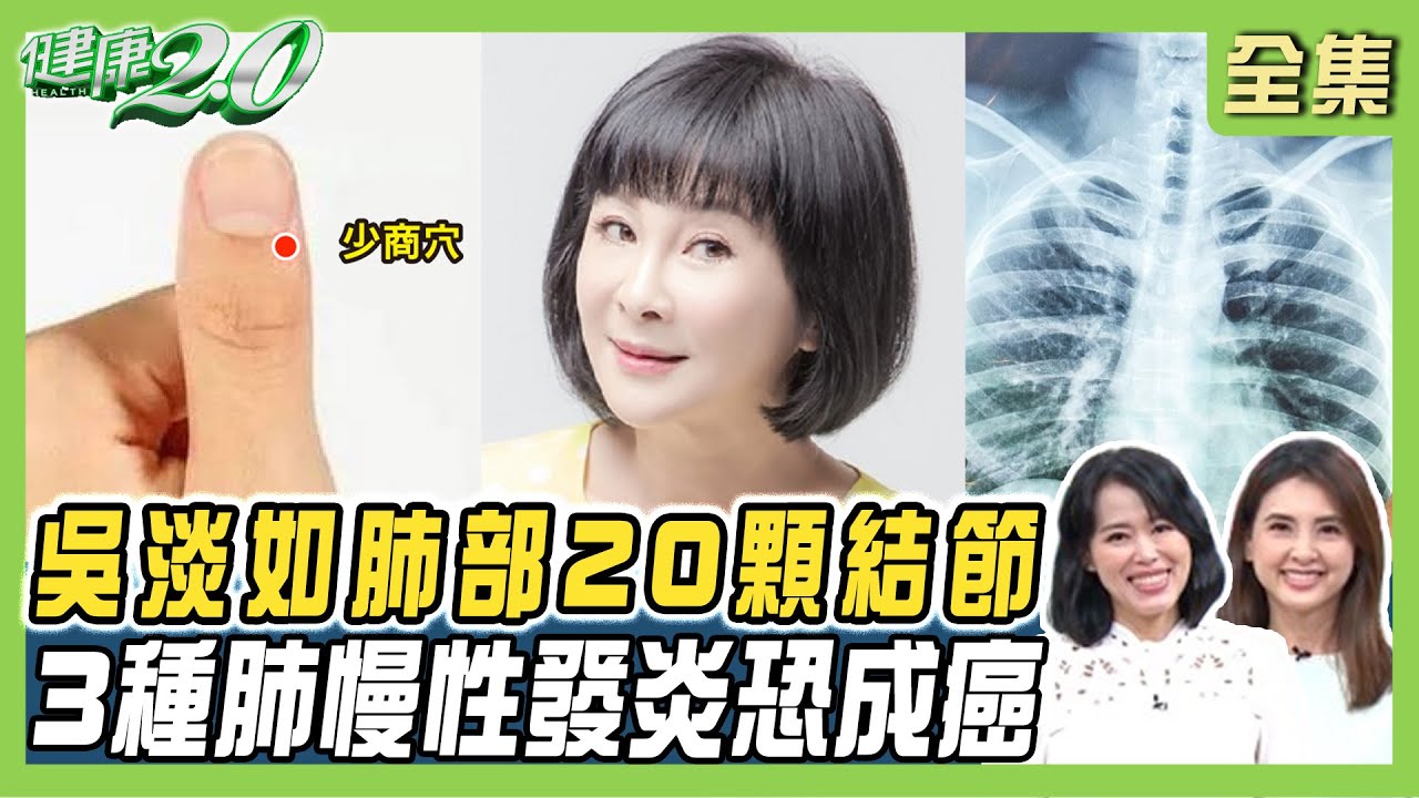 吳淡如肺驚見20顆結節！肺結節大小.形狀是關鍵 逾1公分惡性高！陸1.5億人肺結節高危 3肺慢性發炎恐成癌！ 健康2.0 20241229【完整版】陳欣湄 韋汝 周百謙 戴承正 陳少偉 鄒瑋倫 陸巧因