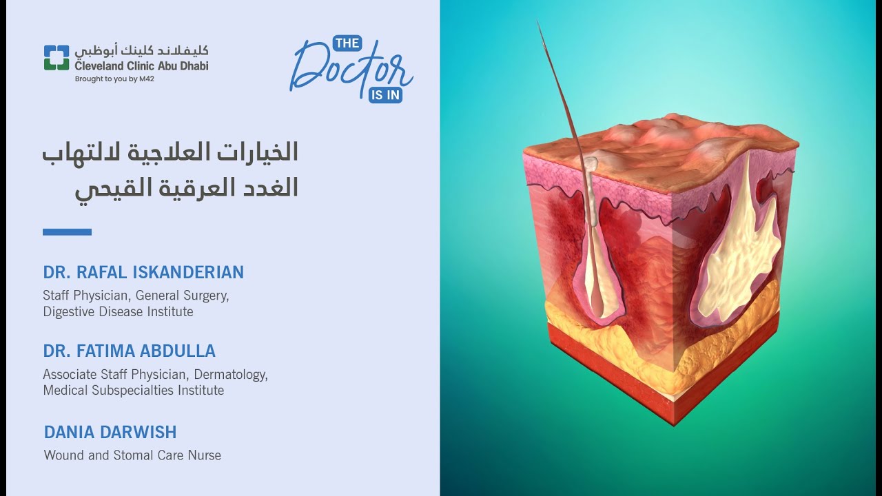 الخيارات العلاجية لالتهاب الغدد العرقية القيحي