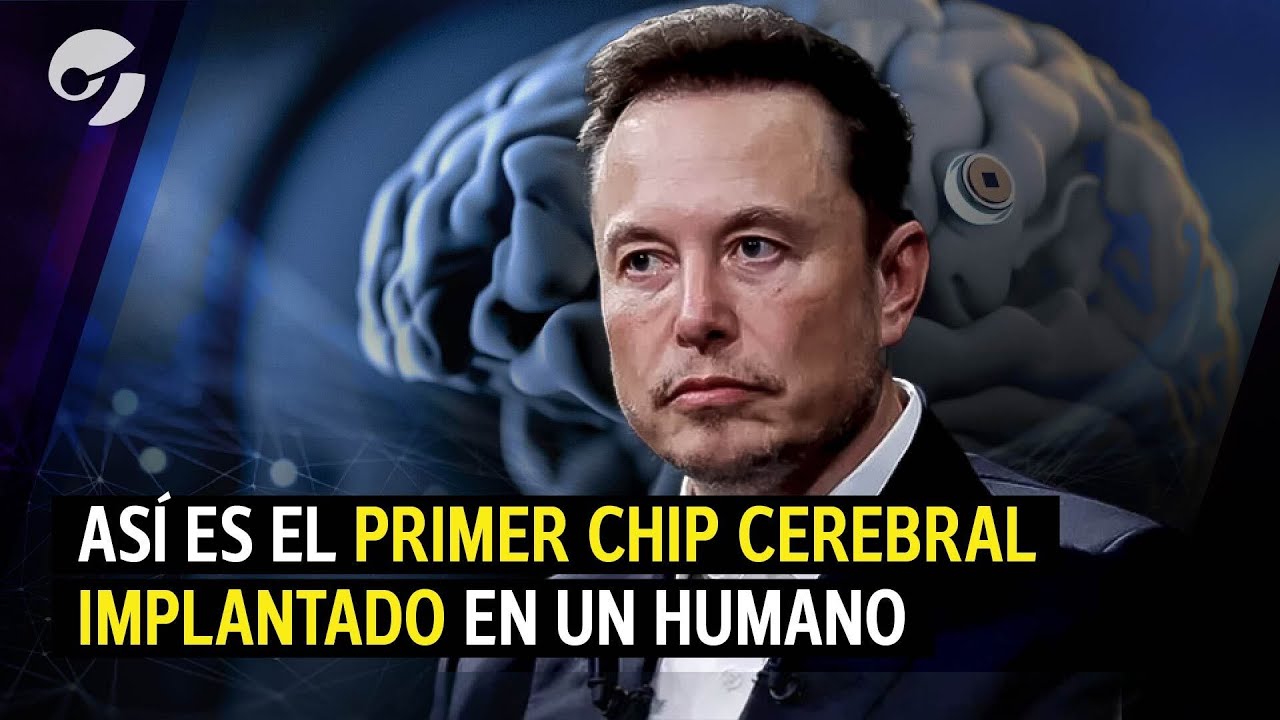 Cómo funciona TELEPATHY,  EL CHIP CEREBRAL que una empresa de ELON MUSK implantó en un HUMANO