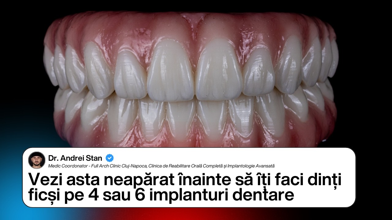 Medic specializat in implantologie iti explica totul despre dintii ficsi pe implanturi dentare