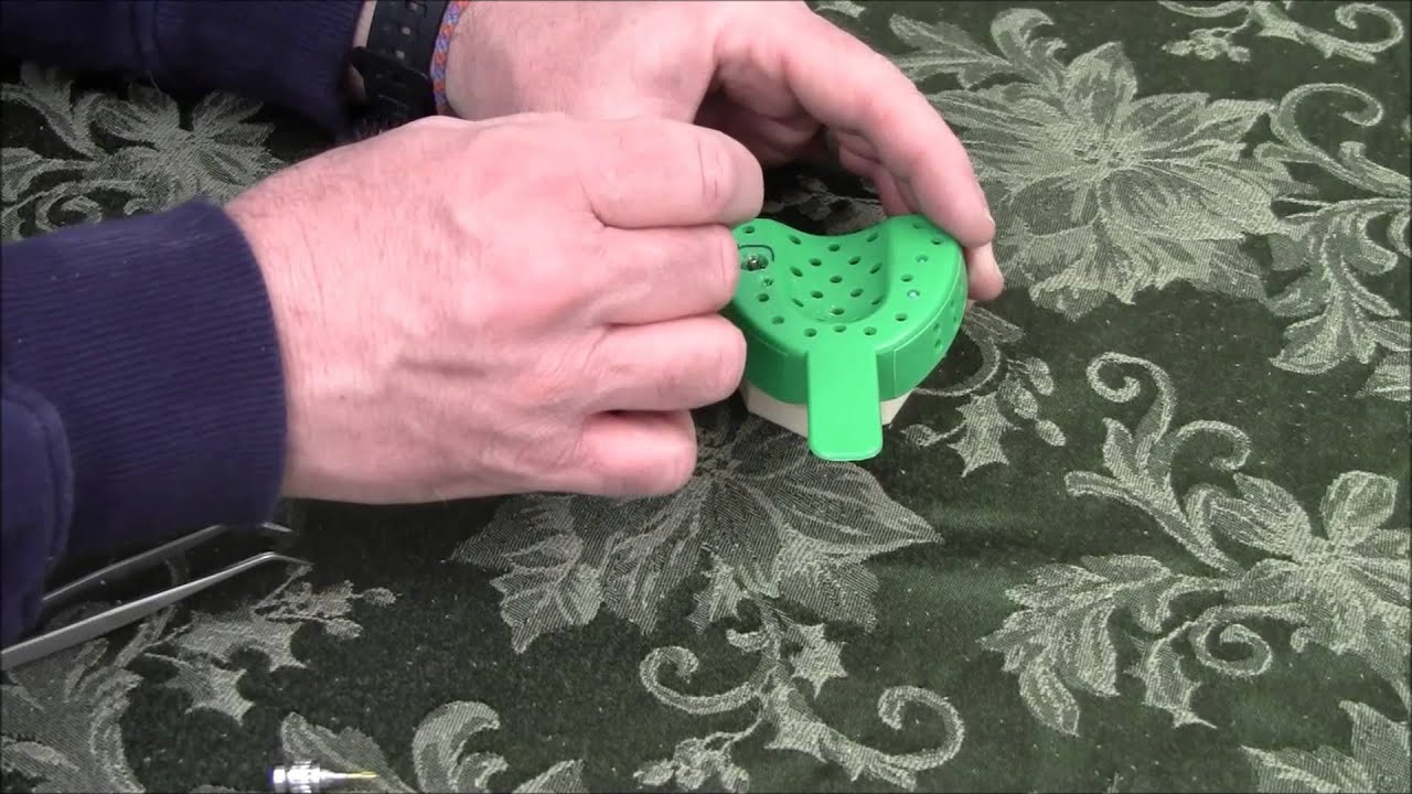 Open Tray Impression Technique