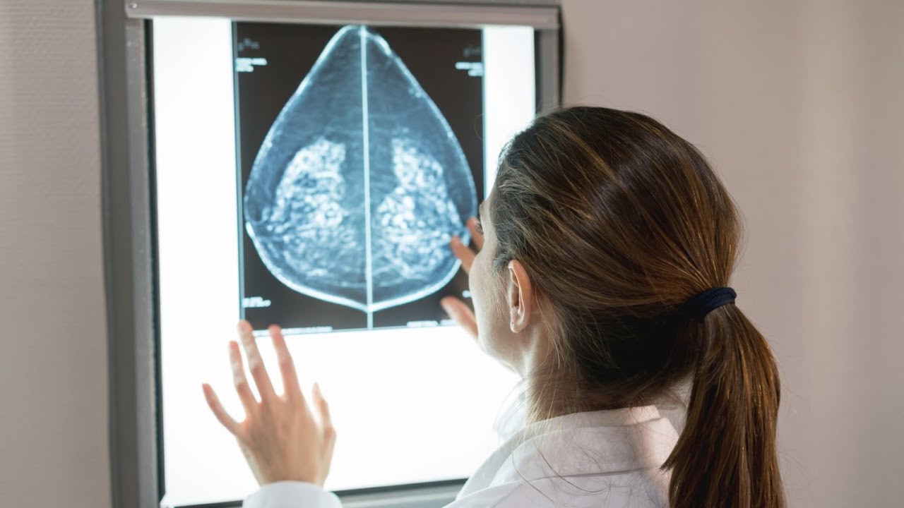 What does breast cancer look like on a mammogram?