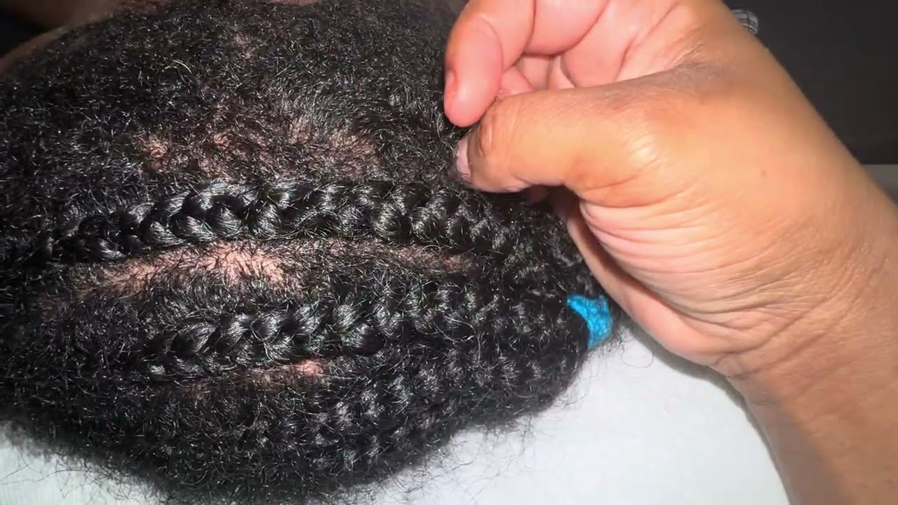 Aggressive Scalp Scratching & Nitpicking ASMR | Loud Tools, Coarse Hair