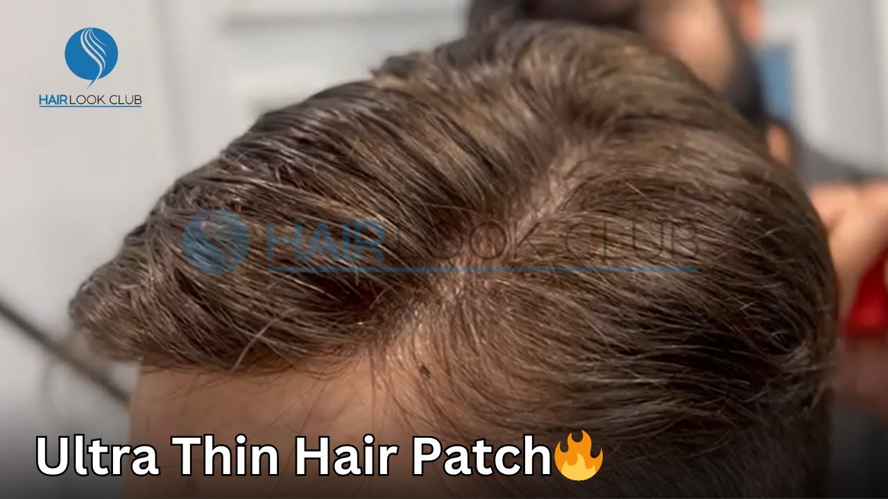 Ultra Thin Hair Patch | 100% Natural Hair Patch 🔥 | Hair Look Club