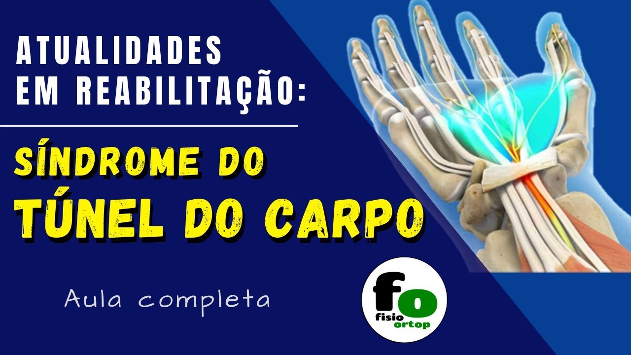 Síndrome do tunel do carpo: o que temos de evidências mais atuais? | Aula Completa