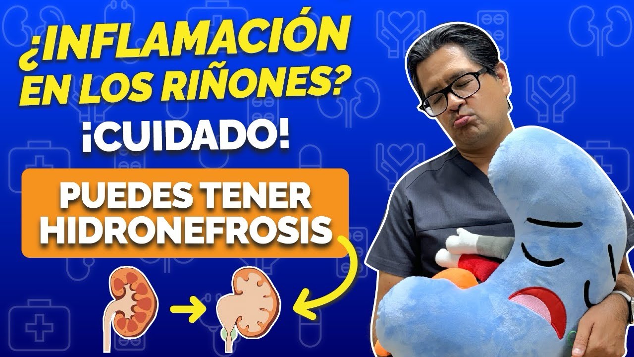 Inflamación en los riñones ¡CUIDADO! Puedes tener HIDRONEFROSIS