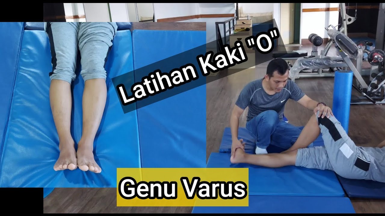 Latihan untuk kaki O ||genu varus