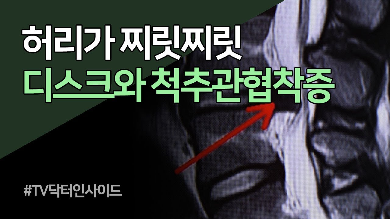 허리디스크와 척추관협착증 / TV닥터인사이드 부산MBC 20191104 방송