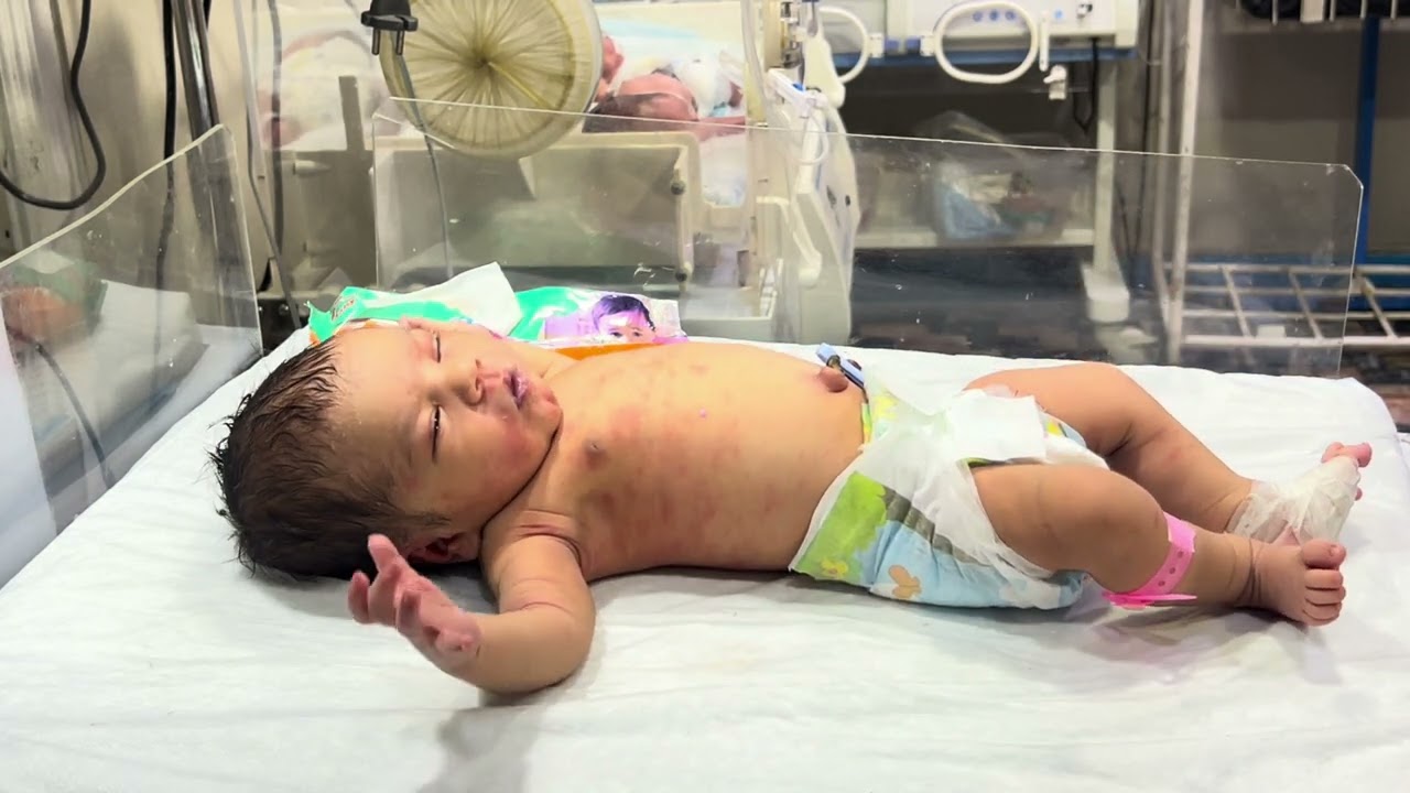 Cute Baby Feeding Movement – First Sweet Moments in Our NICU