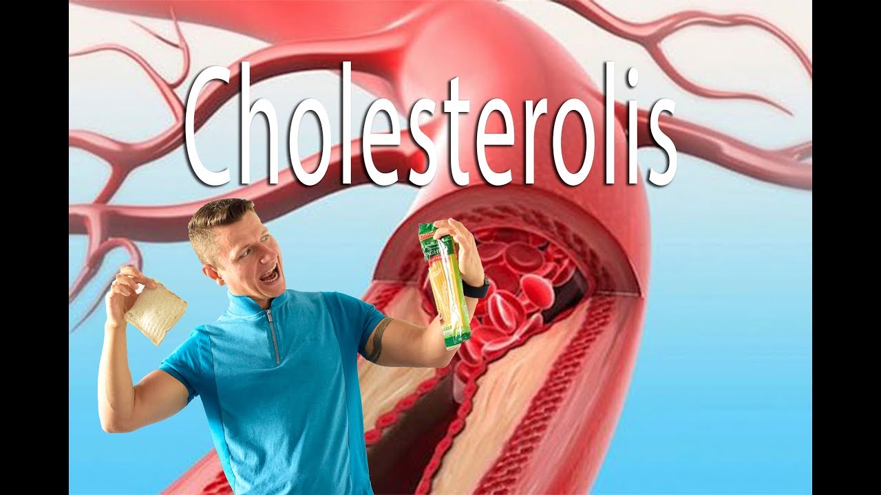 Visa tiesa apie cholesterolį